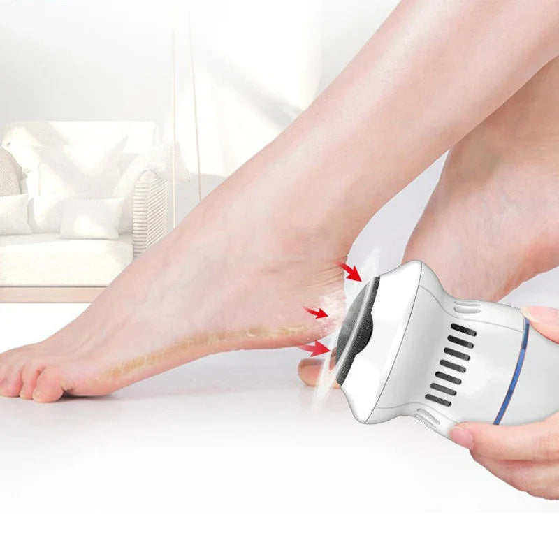 FootFresh™ Professional Electric Callus Remover