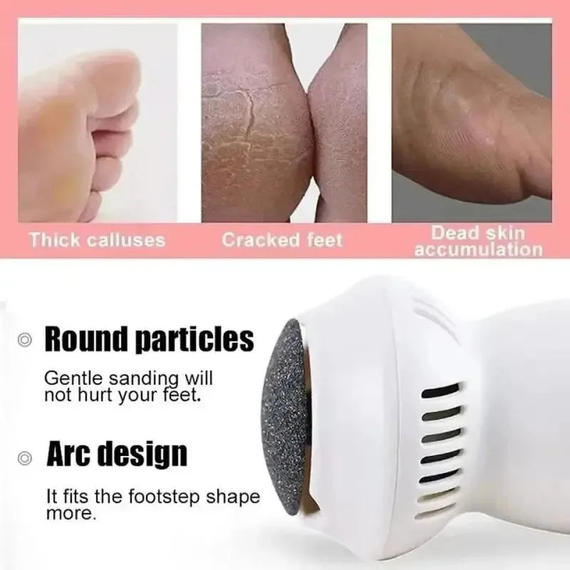 FootFresh™ Professional Electric Callus Remover